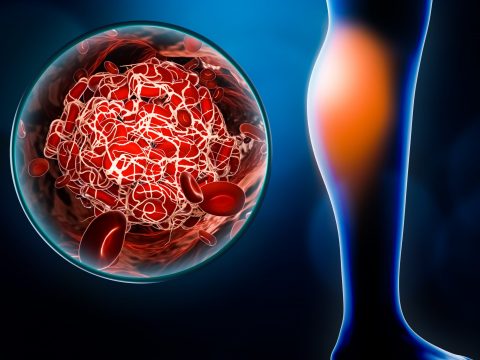 Schedule your vascular screenings
