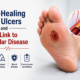 Non-Healing Foot Ulcers and Their Link to Vascular Disease